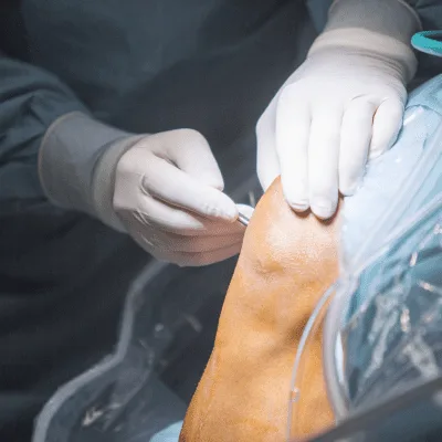 Atención integral para el dolor de hombro en Naucalpan