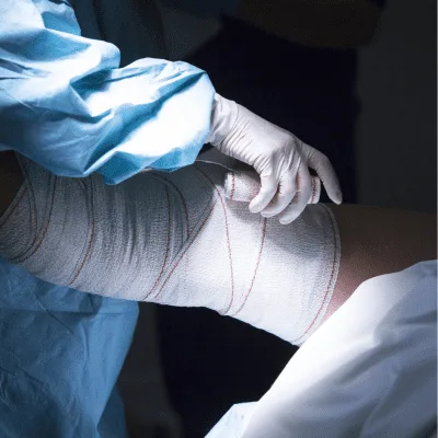 Especialista en el tratamiento integral de fracturas en Naucalpan