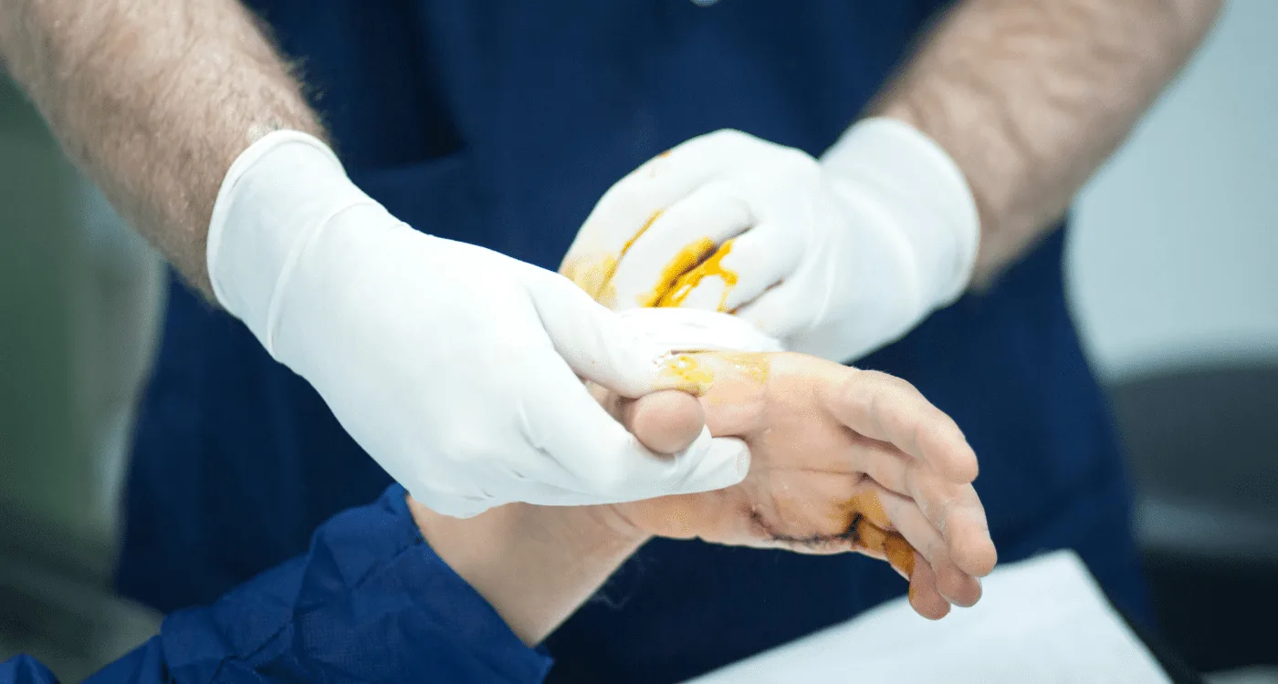 ¿Qué especialista trata las fracturas?