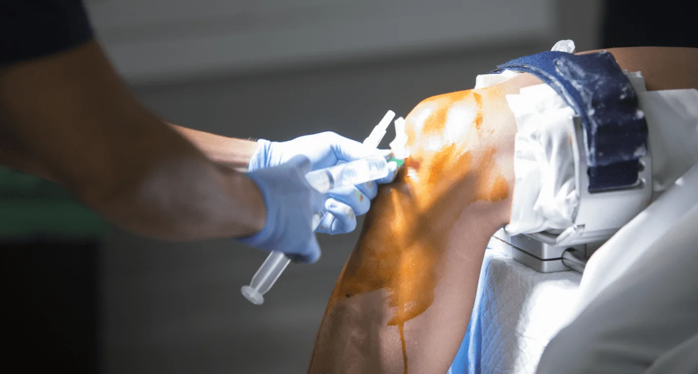 Lesiones musculares en Naucalpan: guía completa para entender y tratar el dolor